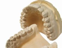 los moldes que utilizan los dentistas en el gabinete dental por horas