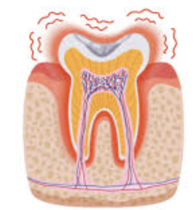 dientes sensibles en verano
